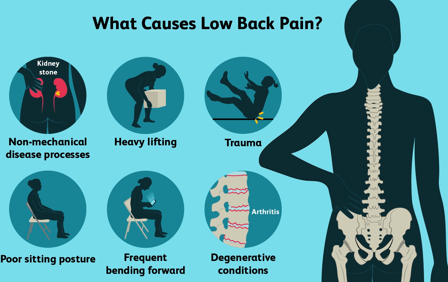 Causes of low back pain including heavy lifting, trauma, poor sitting posture, frequent bending and degenerative conditions