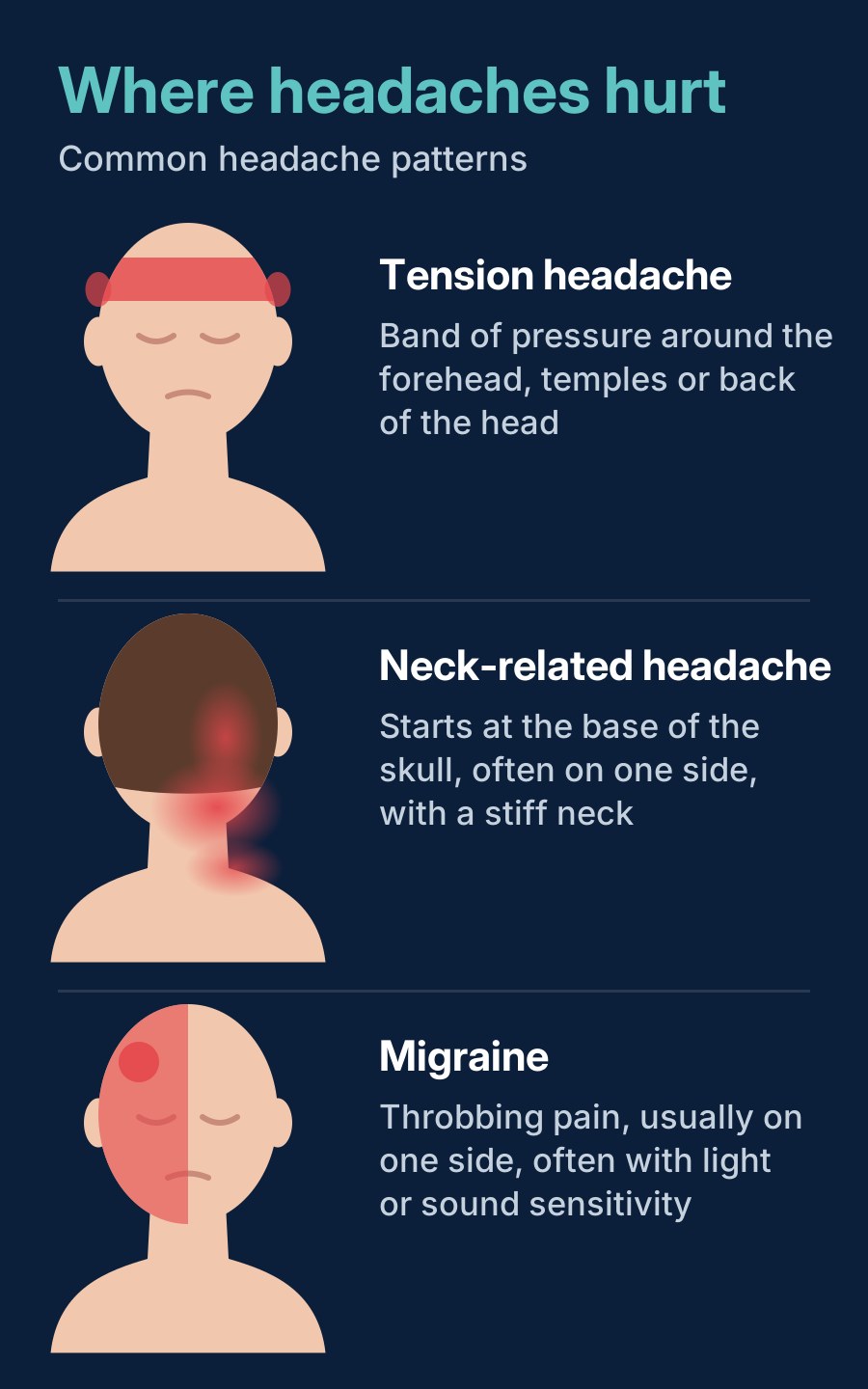 Where headaches hurt: tension headache around the forehead and temples, neck-related headache at the base of the skull, and migraine on one side of the head