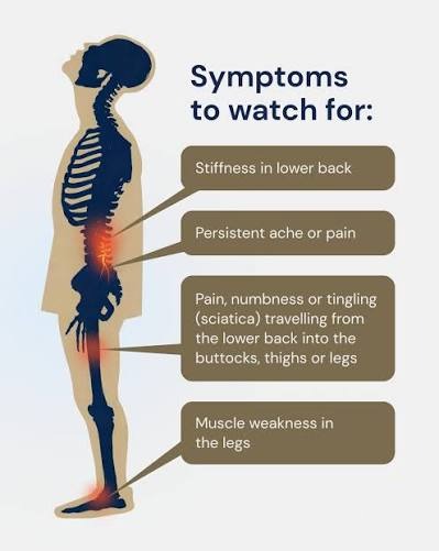 Low back pain symptoms: stiffness, persistent ache, pain or tingling into the legs, and leg weakness