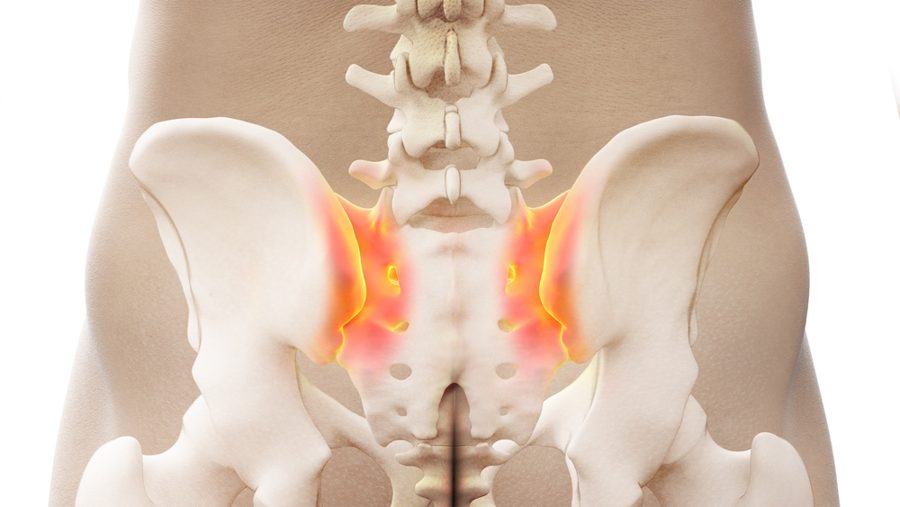 Sacroiliac (SI) joints highlighted where the low back meets the pelvis